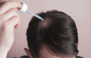 Unlocking the Secrets of Minoxidil Treatment: Why Patience and Persistence Are Key