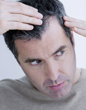 Understanding Hair Loss: Causes and Solutions